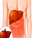 Tài liệu: Viêm gan do siêu vi từ A tới G