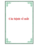 Các bệnh về mắt