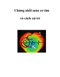 Chứng nhồi máu cơ tim và cách xử trí  