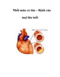 Nhồi máu cơ tim – Bệnh của mọi lứa tuổi   