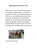 Hội chứng MMA trên heo nái 