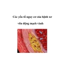 Các yếu tố nguy cơ của bệnh xơ vữa động mạch vành  