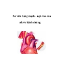 Xơ vữa động mạch - ngõ vào của nhiều bệnh chứng  