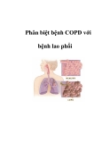 Phân biệt bệnh COPD với bệnh lao phổi  