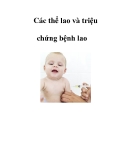 Các thể lao và triệu chứng bệnh lao  