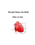 Ba giai đoạn của bệnh viêm cơ tim  