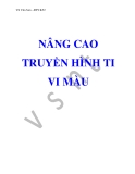 Nâng cao truyền hình ti vi màu