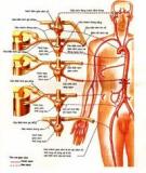 PHẪU THUẬT SỬA CHỮA HỒI LƯU TĨNH MẠCH PHỔI BẤT THƯỜNG HOÀN TOÀN