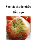 Sẹo và thuốc chữa liền sẹo