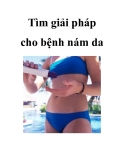 Tìm giải pháp cho bệnh nám da