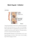 Bệnh Osgood - Schlatter 