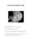 X QUANG SỌ QUI ƯỚC 