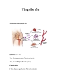 Tăng tiểu cầu 