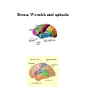 Broca, Wernick and aphasia 