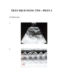 TRÀN DỊCH MÀNG TIM – PHẦN 2 