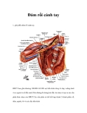 Đám rối cánh tay 