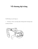 Vết thương đại tràng 