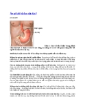 Ăn gì khi bị đau dạ dày