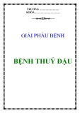 TỔNG QUAN BỆNH THUỶ ĐẬU