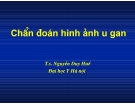 Chẩn doán hình ảnh : U Gan part 1