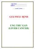 UNG THƯ GAN (LIVER CANCER)