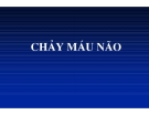 CHẢY MÁU NÃO