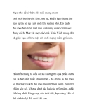 Mẹo nhỏ để sỡ hữu đôi môi mọng mềm 