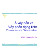 Á vảy nến và Vảy phấn dạng lichen