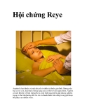 Hội chứng Reye  