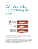 Cơn đau thắt ngực không ổn định  