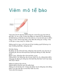 Viêm mô tế bào  