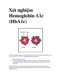 Xét nghiệm Hemoglobin A1c (HbA1c)  