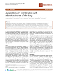 báo cáo khoa học: "Aspergilloma in combination with adenocarcinoma of the lung"