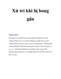 Xử trí khi bị bong gân