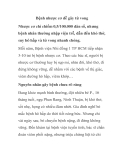 Bệnh nhược cơ dễ gây tử vong