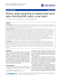 Báo cáo y học: " Pontine stroke presenting as isolated facial nerve palsy mimicking Bell’s palsy: a case report"