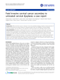 Báo cáo y học: "Fatal invasive cervical cancer secondary to untreated cervical dysplasia: a case report"