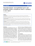 báo cáo khoa học: "Dysembryoplastic neuroepithelial tumor and probable sudden unexplained death in epilepsy: a case report "