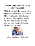 Sơ cứu đúng cách khi trẻ bị chảy máu mũi 