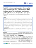 Báo cáo y học: "Portal hypertensive enteropathy diagnosed by capsule endoscopy and demonstration of the ileal changes after transjugular intrahepatic portosystemic shunt placement: a case report"