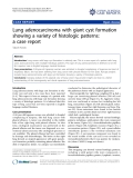 báo cáo khoa học: " Lung adenocarcinoma with giant cyst formation showing a variety of histologic patterns: a case report"