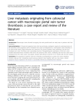 báo cáo khoa học: "Liver metastasis originating from colorectal cancer with macroscopic portal vein tumor thrombosis: a case report and review of the literature"
