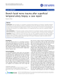 báo cáo khoa học: " Branch facial nerve trauma after superficial temporal artery biopsy: a case report"