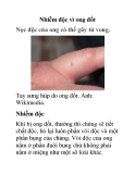 Nhiễm độc vì ong đốt 
