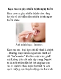 Kẹo cao su gây nhiều bệnh nguy hiểm 