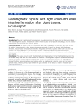 Báo cáo y học: "Diaphragmatic rupture with right colon and small intestine herniation after blunt trauma: a case report"