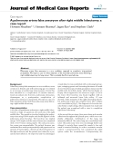 Báo cáo khoa hoc:" A pulmonary artery false aneurysm after right middle lobectomy: a case report"