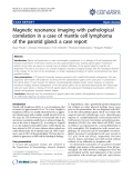 Báo cáo y học: " Magnetic resonance imaging with pathological correlation in a case of mantle cell lymphoma of the parotid gland: a case report"