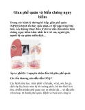 Gian phế quản và biến chứng nguy hiểm