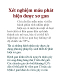 Xét nghiệm máu phát hiện được xơ gan